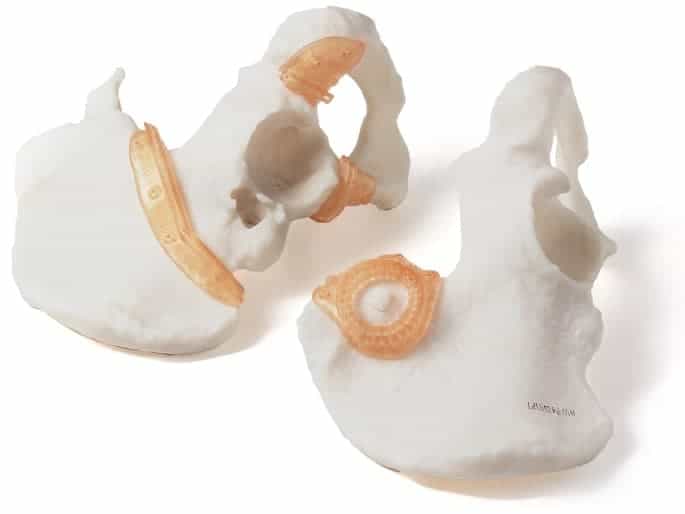 Realistic ear prosthetic model used for surgical planning and patient education.